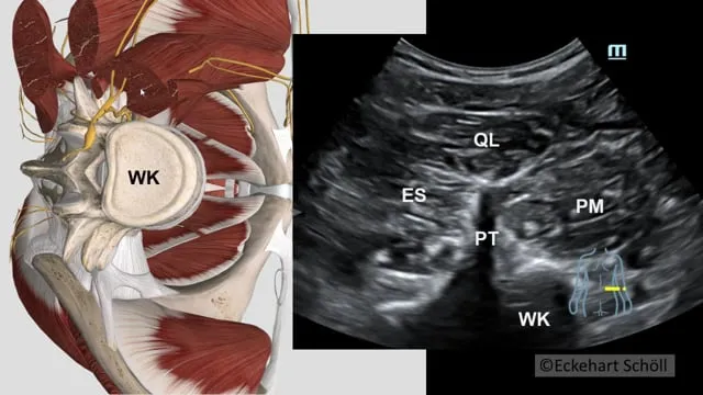 Plexus lumbalis